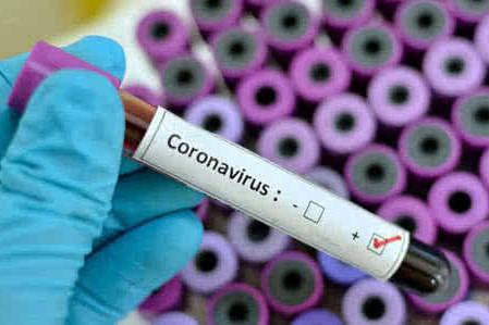 Коронавірус: як захищатимуть чернігівців