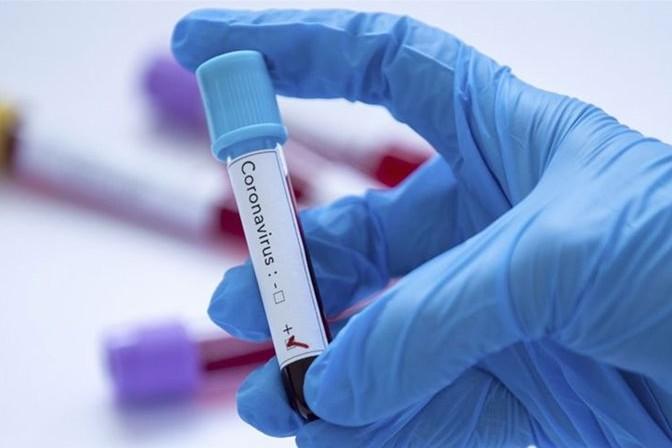 Оперативна інформація про поширення коронавірусної інфекції: 43 нові випадки