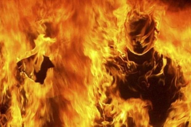 На Чернігівщині чоловік хотів покінчити життя самогубством, підпаливши себе