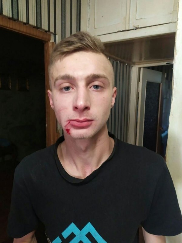 На Чернігівщині розшукують ймовірного 21-річного ґвалтівника (ОНОВЛЕНО)