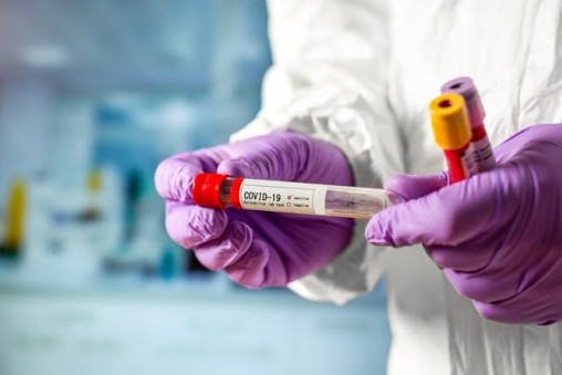 За добу на Чернігівщині +7 хворих на коронавірус