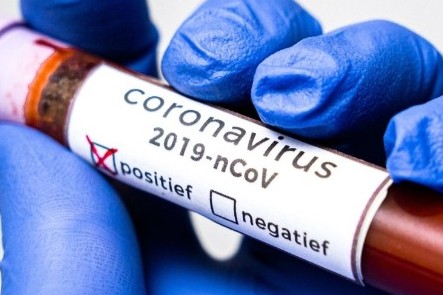Голова громади на Чернігівщині захворів на коронавірус