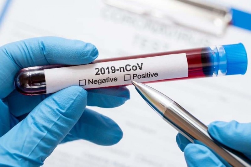 У Чернігові різко зросла кількість хворих на Covid-19: оперативна інформація