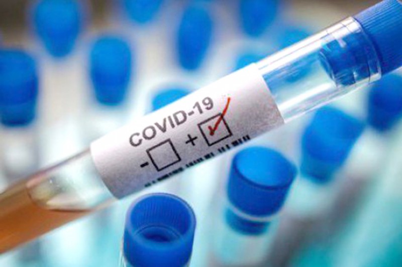 На Чернігівщині +26 нових випадків COVID-19. ОНОВЛЕНО