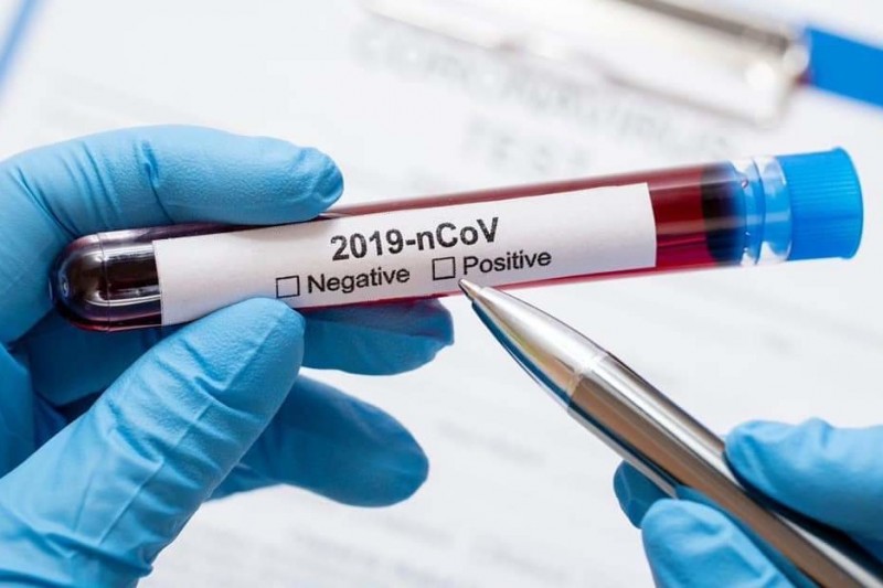 На Чернігівщині – 8 нових випадків інфікування коронавірусом