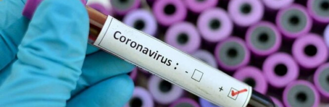 В Чернігові 9 нових випадкі COVID-19 і ще одна смерть