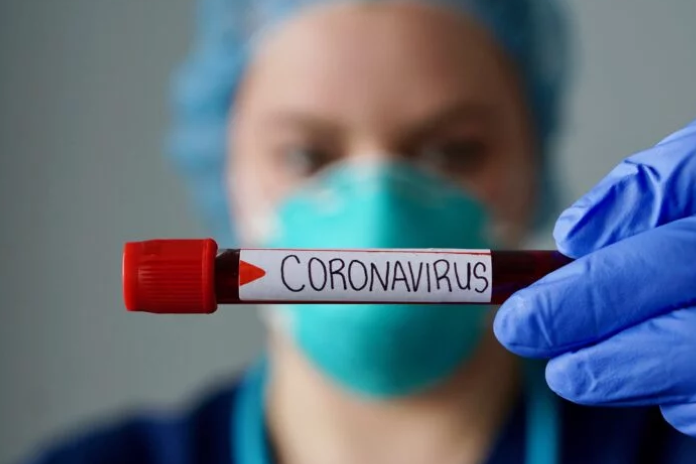 У Чернігівській області виявлено 83 нові випадки COVID-19
