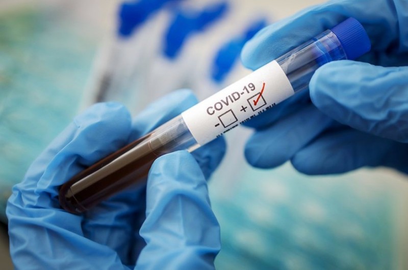 У Чернігівській області виявлено 68 нових випадків коронавірусної хвороби