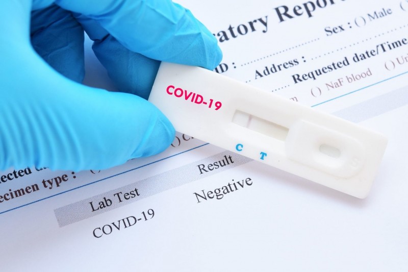 Коронавірус: чи безкоштовне тестування?
