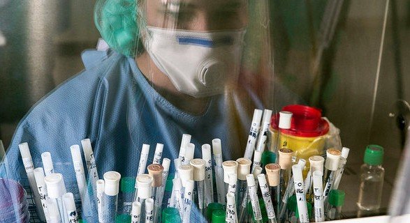 Чернігівці серед лідерів: за добу на Чернігівщині захворіли на коронавірус 64 людини