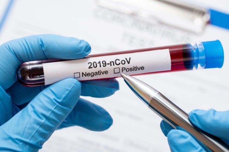 Новий антирекорд: на Чернігівщині 786 нових випадків коронавірусу