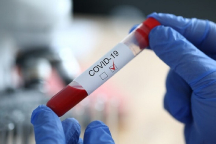 У Чернігівській області понад 600 нових випадків COVID-19 за добу