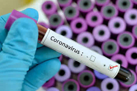 У Чернігівській області виявлено 216 нових випадків COVID-19