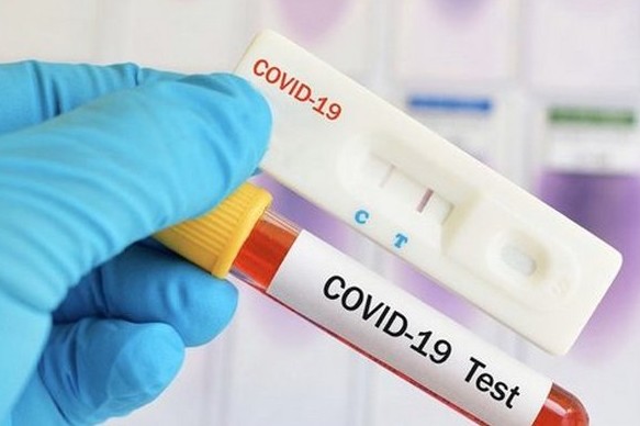 У Чернігівській області виявлено 499 нових випадків COVID-19