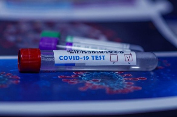 78 нових випадків коронавірусної інфекції зафіксовано за добу на Чернігівщині