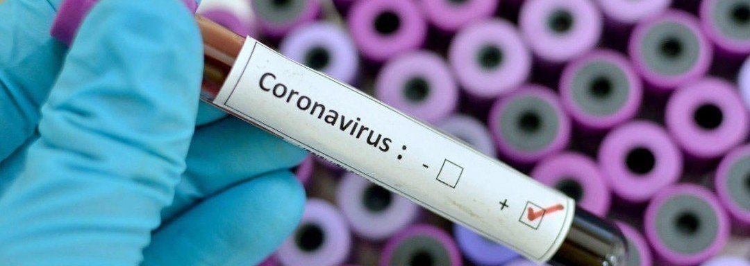 Спад коронавірусу у Чернігові відкладається. Маємо більше 200 нових хворих за добу