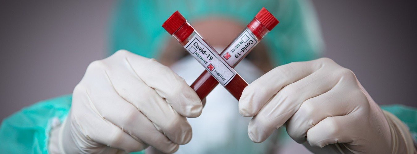 Свіжа статистика по коронавірусу – у Чернігові 123 нових випадки