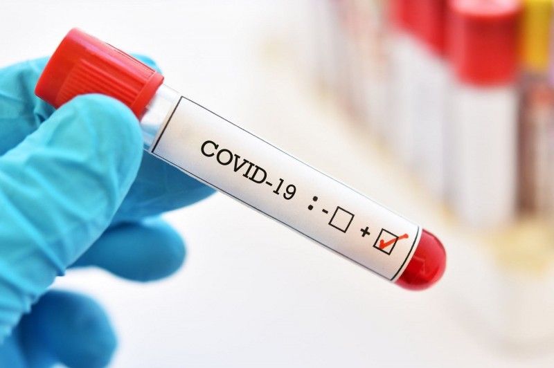 У Чернігівській області виявлено 256 нових випадків COVID-19