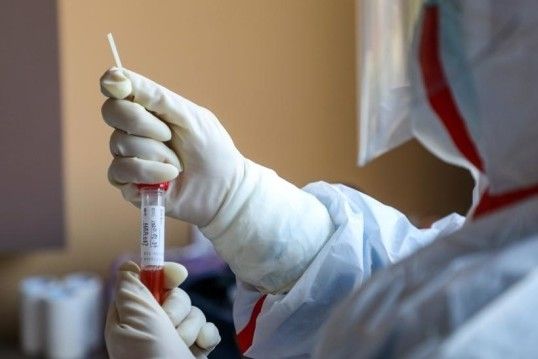 У Чернігові – сім пунктів безкоштовних тестувань на коронавірус