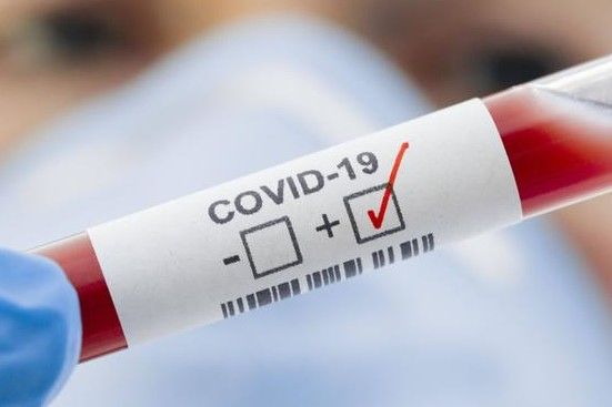 У Чернігівській області виявлено 66 нових випадків COVID-19