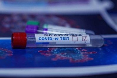 У Чернігівській області виявлено 92 нових випадки COVID-19