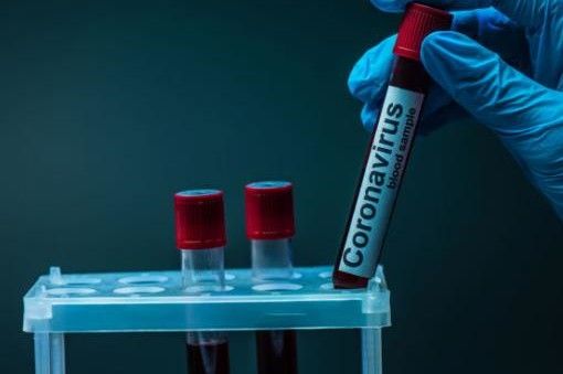 У Чернігівській області виявлено 194 нові випадки COVID-19