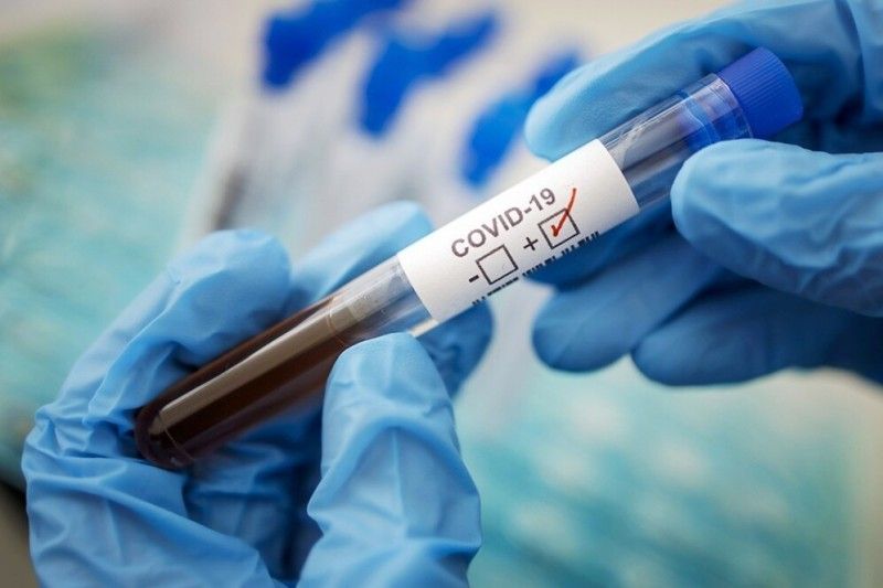 На Чернігівщині за добу зафіксовано 726 нових випадків захворювання на коронавірус