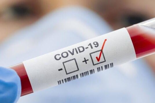 За минулу добу в Чернігівській області виявлено 520 нових випадків COVID-19