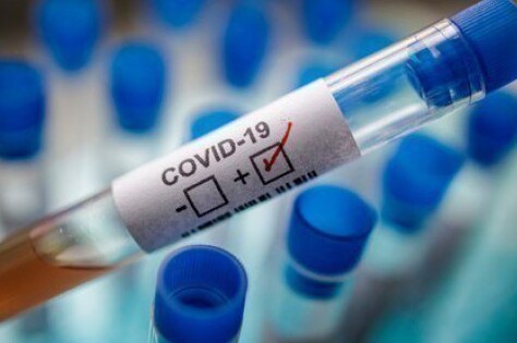 За минулу добу в Чернігівській області виявлено 380 нових випадків COVID-19