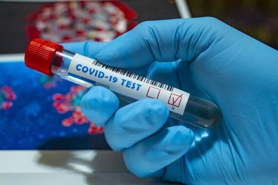 За минулу добу в Чернігівській області виявлено 57 нових випадків COVID-19