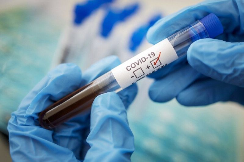 Коронавірус йде на спад: за добу на Чернігівщині 4 нових випадки захворювання