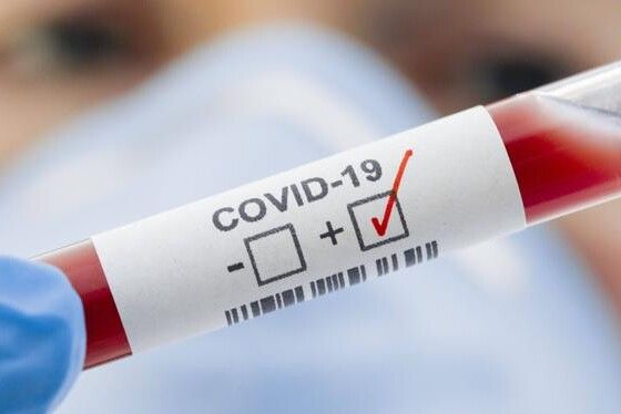 За минулу добу в Чернігівській області виявлено 11 нових випадків COVID-19