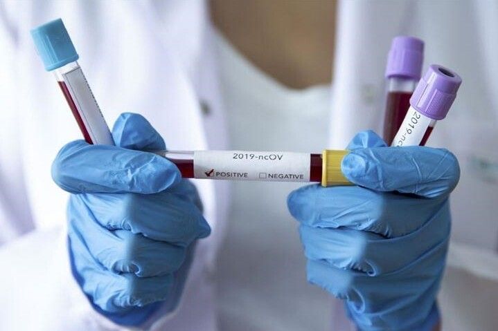 В Україні за добу виявлено 852 нові випадки COVID-19