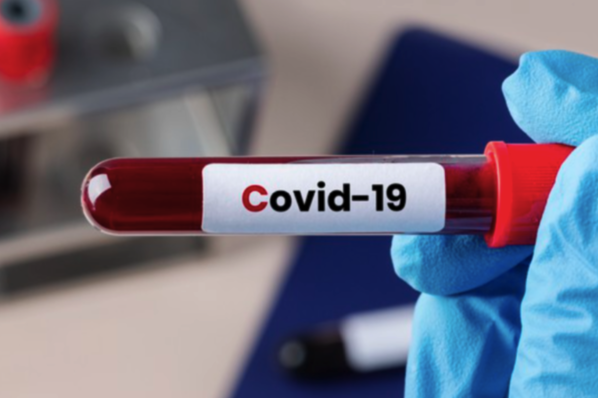 За минулу добу в Україні виявлено 479 нових випадків COVID-19