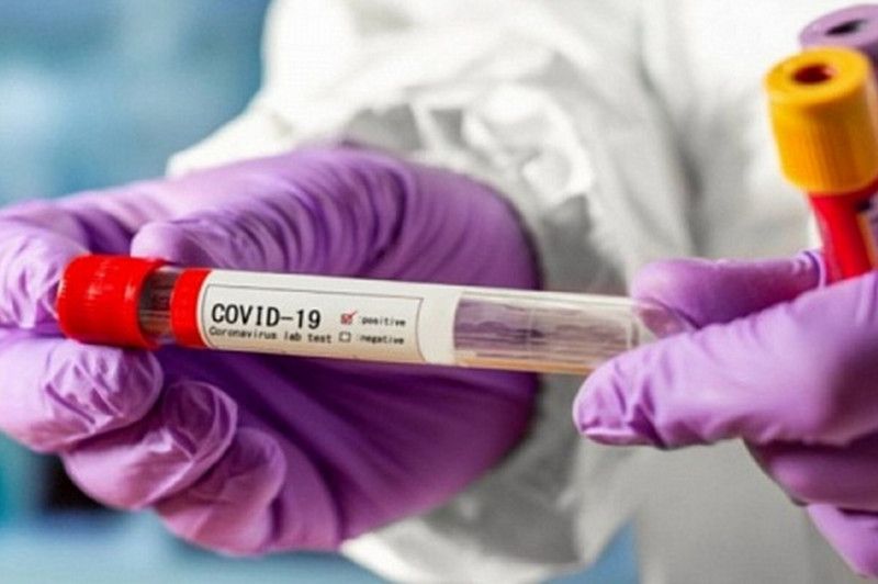 Коронавірусна статистика: в Україні виявлено 623 нові випадки COVID-19