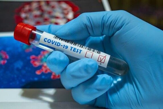 На Чернігівщині зафіксовано 5 нових випадків захворювання на коронавірус за добу