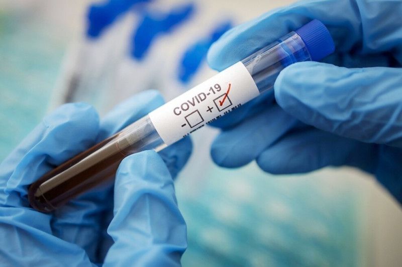 На Чернігівщині за добу 41 випадок захворювання на коронавірус