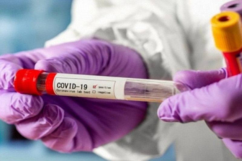 За минулу добу в Чернігівській області виявлено 125 нових випадків COVID-19