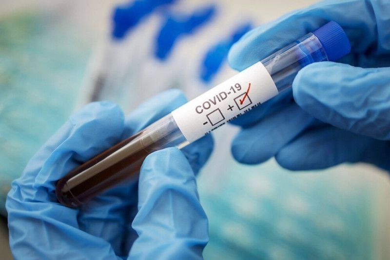 В Україні зафіксовано різкий стрибок нових випадків коронавірусу