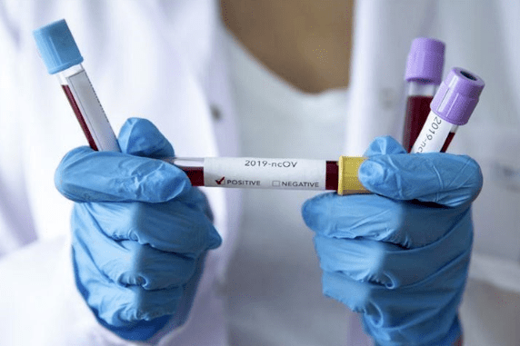 За минулу добу в Чернігівській області виявлено 58 нових випадків COVID-19