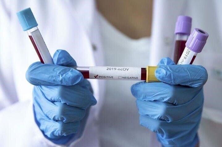 За минулу добу в Чернігівській області виявлено 161 новий випадок COVID-19