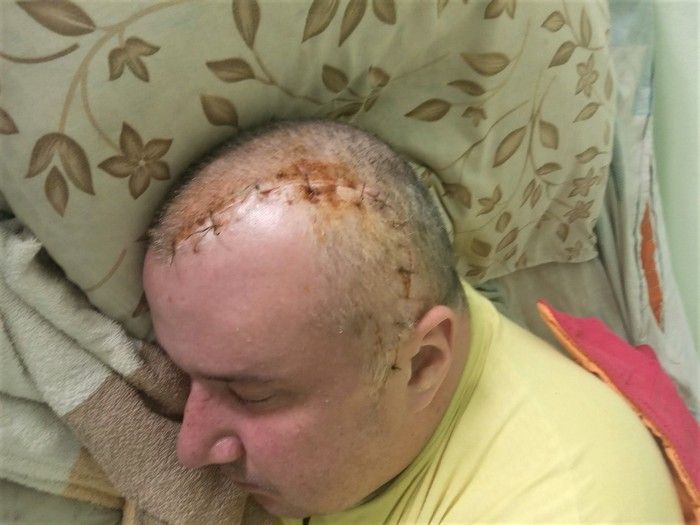 35-річному чернігівцю після раптового інсульту потрібна допомога - новости Чернигова