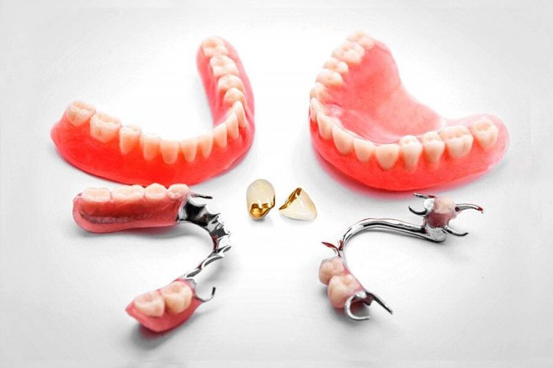 Протезування зубів види, ціни та нові технології при повній відсутності зубів