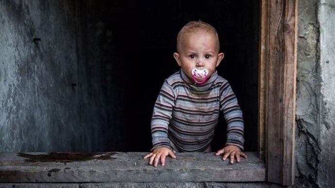 На Чернігівщині внаслідок війни постраждало 68 дітей