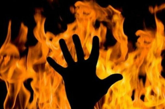 У Десні горіла квартира: жінка отримала 50% опіків тіла в результаті пожежі