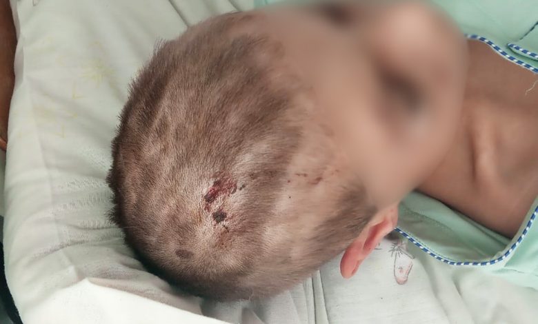 Катував та п’ять діб не випускав з оселі жінку з дітьми: поліція затримала підозрюваного у злочинах (Фото)