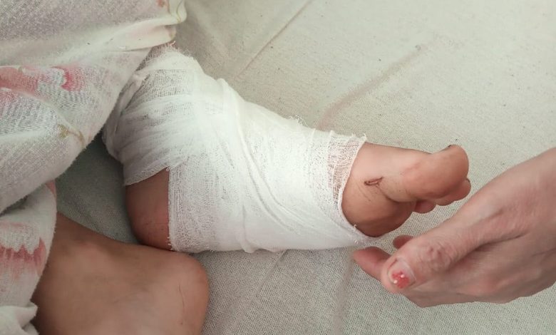 Катував та п’ять діб не випускав з оселі жінку з дітьми: поліція затримала підозрюваного у злочинах (Фото)