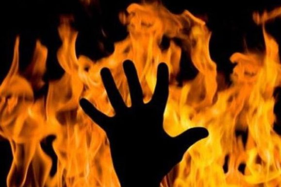 На Чернігівщині в результаті пожежі чоловік отримав опіки