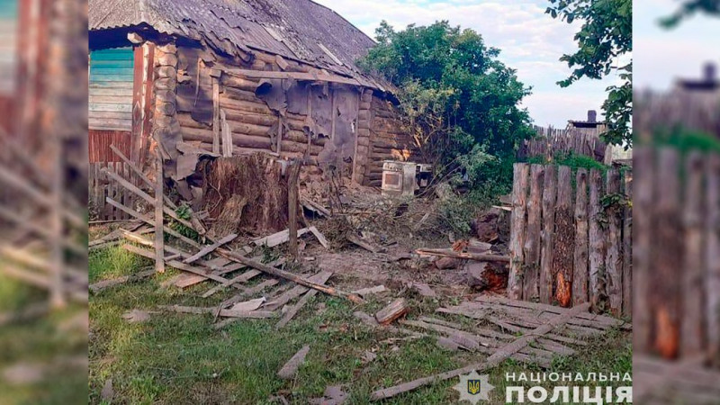 "Я не думала, що виживу": поранена Раїса Бавикіна з прикордоння Чернігівщини про обстріл