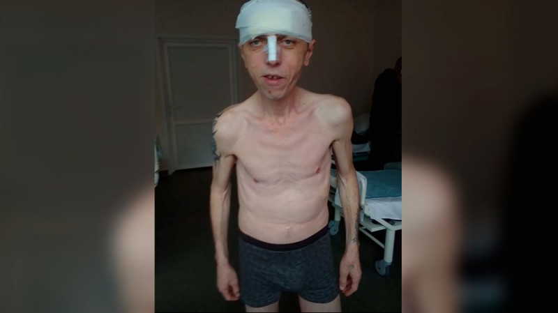 7 разів вивозили на розстріл, вербували для здачі позицій ЗСУ, катування струмом у полоні: історія оборонця Чернігова